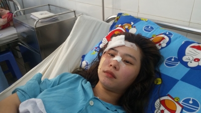 Nạn nh&acirc;n kể lại ph&uacute;t kinh ho&agrave;ng khi xe kh&aacute;ch bị lật ở đ&egrave;o Hải V&acirc;n