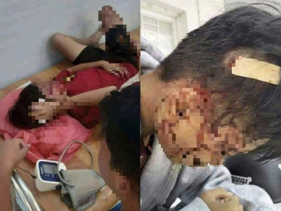 Nam sinh ở An Giang cầm hung khí quật liên tiếp vào đầu bạn