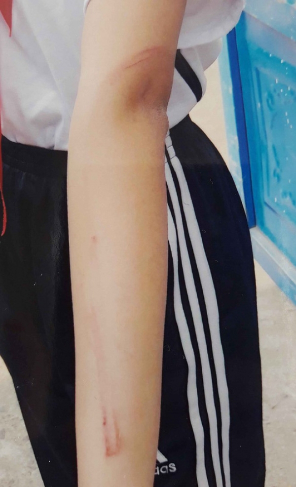 Mẹ qua đời, b&eacute; g&aacute;i 12 tuổi thường xuy&ecirc;n bị cha ruột đ&aacute;nh đập