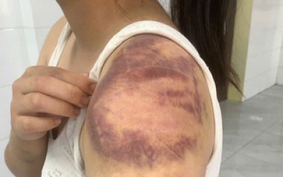 Người đ&agrave;n &ocirc;ng nhiều lần tr&oacute;i, đ&aacute;nh đập con, vợ đang mang thai trong ng&agrave;y Tết