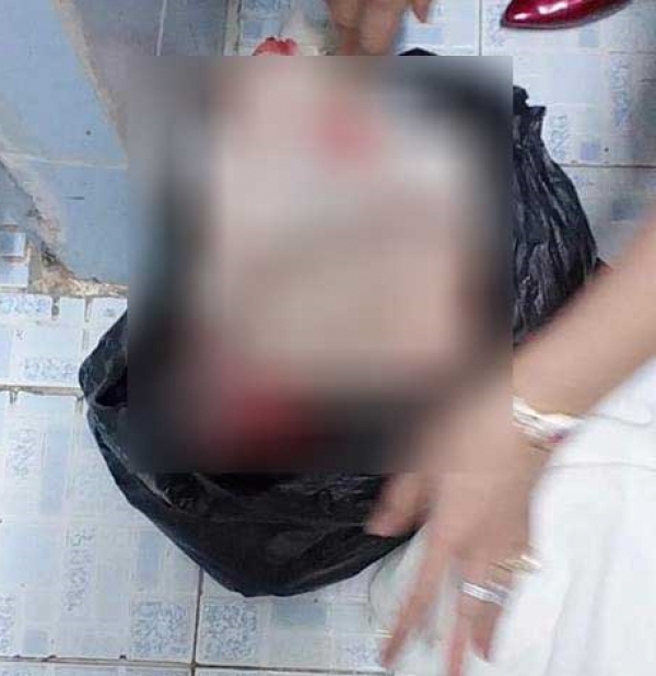 Mẹ sinh con nhỏ ở nh&agrave; vệ sinh bỏ v&agrave;o bịch ni l&ocirc;ng dẫn tới tử vong