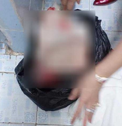 Mẹ sinh con nhỏ ở nh&agrave; vệ sinh bỏ v&agrave;o bịch ni l&ocirc;ng dẫn tới tử vong