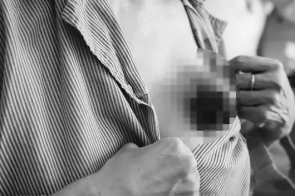 Sợ &quot;đụng dao kéo&quot;, người phụ nữ bỏ dở điều trị và nhận cái kết không ngờ