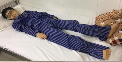 Lạng Sơn: 2 anh em bị tan m&aacute;u cấp nghi do ăn x&ocirc;i c&oacute; phẩm m&agrave;u