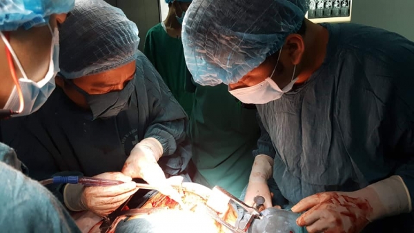 Bệnh viện tỉnh Quảng Trị mổ th&agrave;nh c&ocirc;ng khối u nặng gần 1kg