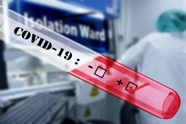 Thiết bị kết hợp điện thoại thông minh cho kết quả COVID-19 trong 30 phút