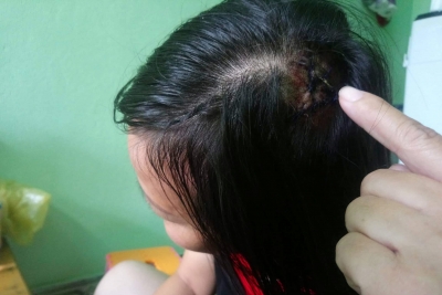 Nữ t&agrave;i xế taxi tố bị bảo vệ bệnh viện d&ugrave;ng tu&yacute;p sắt tấn c&ocirc;ng