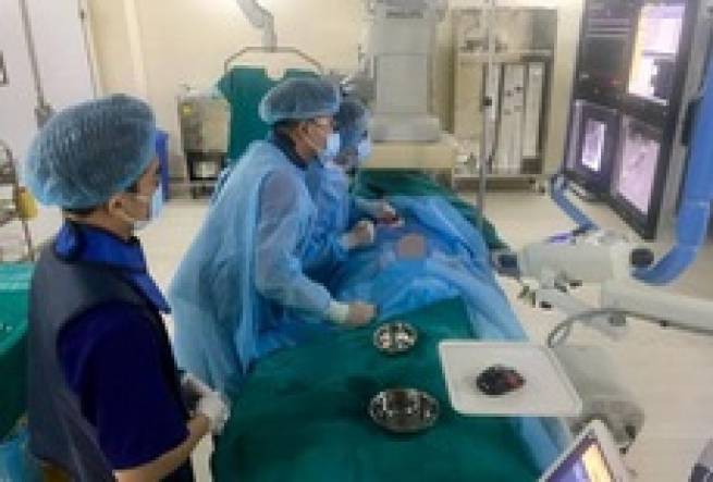 Triệt khối u gan đến 6 cm kh&ocirc;ng cần phẫu thuật