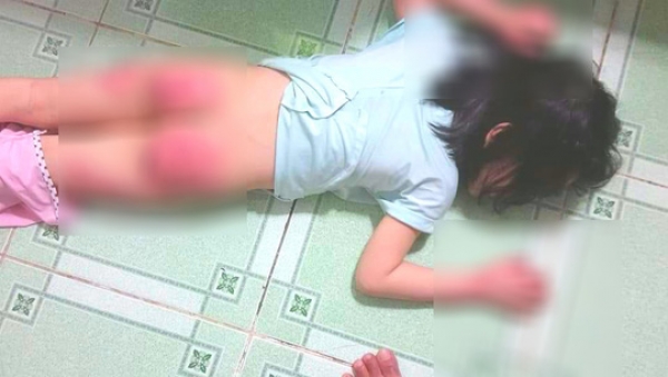 X&oacute;t xa người mẹ cầu cứu v&igrave; con g&aacute;i 6 tuổi bị cha ruột h&agrave;nh hạ d&atilde; man