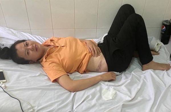 Nữ công nhân ở Đồng Nai bị giám đốc người nước ngoài đánh nhập viện