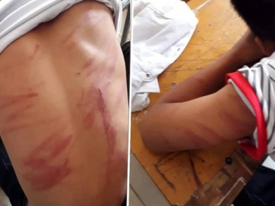 Một học sinh bị bố đẻ đ&aacute;nh đập d&atilde; man