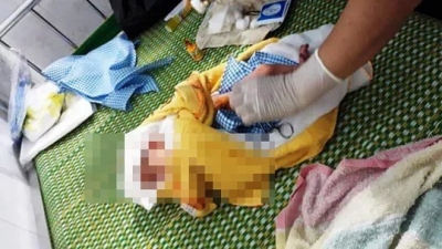 Ph&aacute;t hiện b&eacute; sơ sinh c&ograve;n nguy&ecirc;n d&acirc;y rốn treo tr&ecirc;n xe m&aacute;y