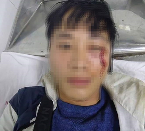 Shipper tố bị kh&aacute;ch đ&aacute;nh chảy m&aacute;u mặt v&igrave; giao h&agrave;ng muộn