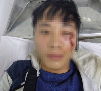 Shipper tố bị kh&aacute;ch đ&aacute;nh chảy m&aacute;u mặt v&igrave; giao h&agrave;ng muộn