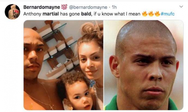 CĐV 'ph&aacute;t sốt' v&igrave; ngoại h&igrave;nh mới của Martial