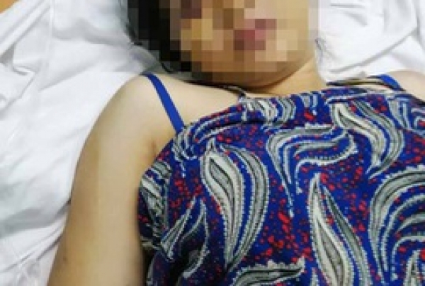Lời kể của c&ocirc; g&aacute;i 18 tuổi bị nh&oacute;m c&ocirc;n đồ tra tấn đến sẩy thai ở B&igrave;nh Ch&aacute;nh