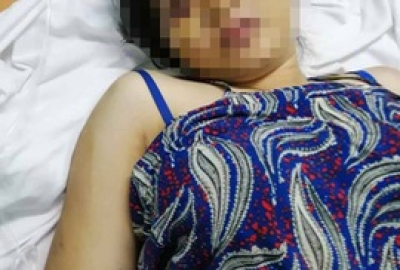 Lời kể của c&ocirc; g&aacute;i 18 tuổi bị nh&oacute;m c&ocirc;n đồ tra tấn đến sẩy thai ở B&igrave;nh Ch&aacute;nh