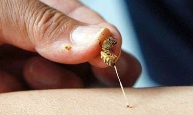 Bị ong đốt, phải l&agrave;m ngay điều n&agrave;y để kh&ocirc;ng bị suy tim, gan, thận