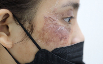 Mỹ phẩm giả tàn phá dung nhan, sức khỏe