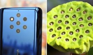 Cụm camera của Nokia 9 PureView khiến người mắc hội chứng sợ lỗ cảm thấy khiếp sợ